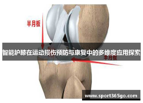 智能护膝在运动损伤预防与康复中的多维度应用探索